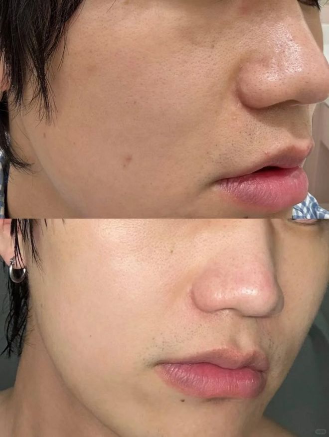 水保湿水乳推荐Top3清单七夕送男朋友必看CQ9电子版入口2025沙漠干皮救星！补(图5)